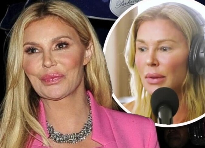 Brandi Glanville S Bad Plastic Surgery 2024 View Before And After