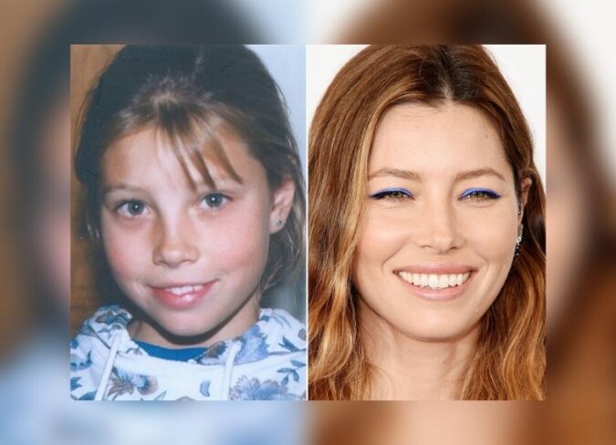 Jessica Biel Plastic Surgery: Is The Sinner Actress Getting a Nose Job ...