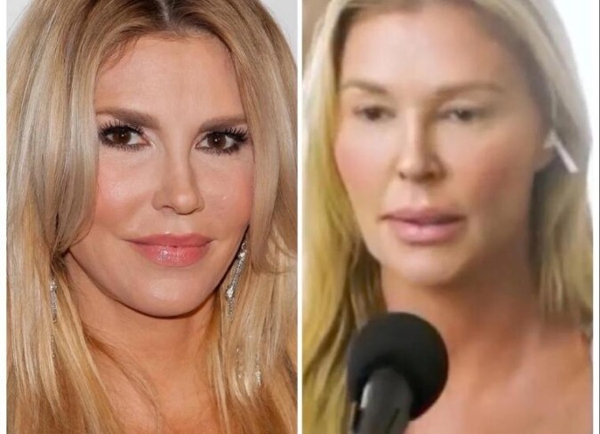 Brandi Glanville's Bad Plastic Surgery 2024: View Before And After ...