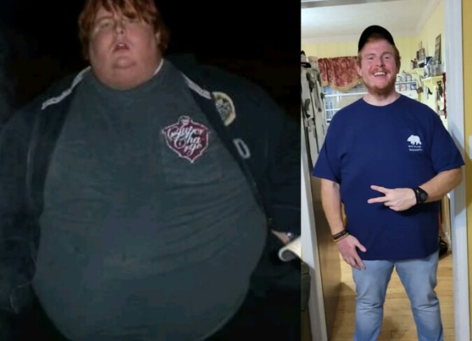 Casey King Weight Loss, Surgery, Diet, & Before & After Photographs