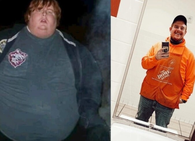 Casey King Weight Loss, Surgery, Diet, & Before & After Photographs