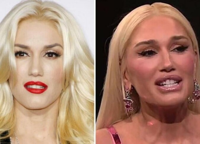 Gwen Stefani Plastic Surgery Interview: Reddit Users Are Curious About ...