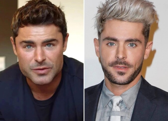 Zac Efron's Plastic Surgery: His Explanation For Why His Appearance Has ...