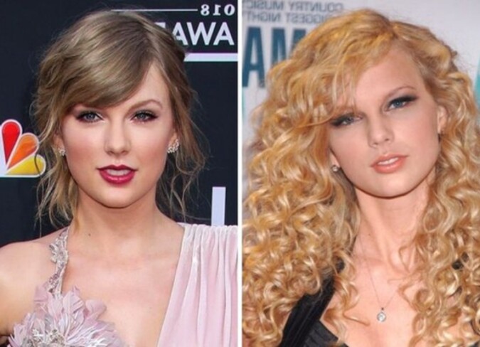 Taylor Swift Blepharoplasty