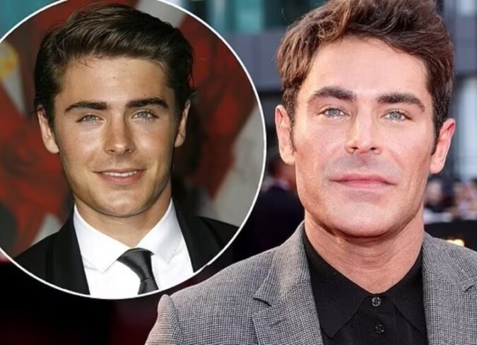 What Happened To The Zac Efrons Jaw Scaled 