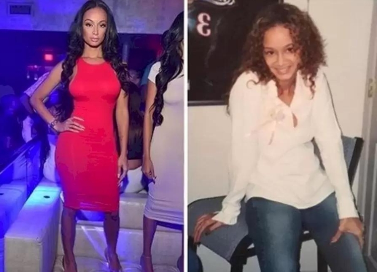 Erica Mena Plastic Surgery: Here Is The Comparison Between Previous And ...