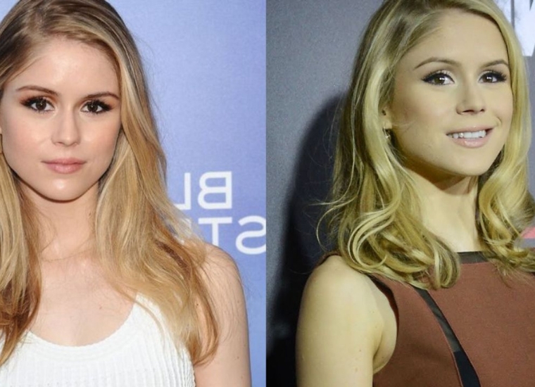 Erin Moriarty Plastic Surgery Erin Looks Different