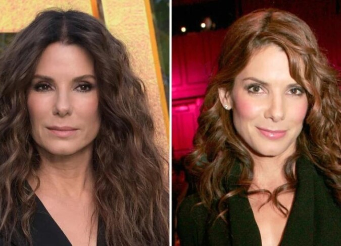 Sandra Bullock Plastic Surgery Sandra Disagree With The Rumors