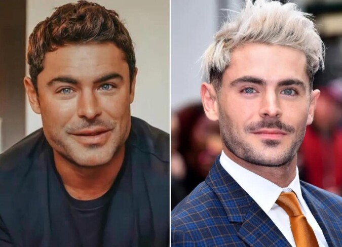 Zac Efron Plastic Surgery Accident Scaled 