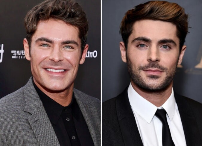 Zac Efron Plastic Surgery Accident: Even After Getting Her Jaw Injured ...